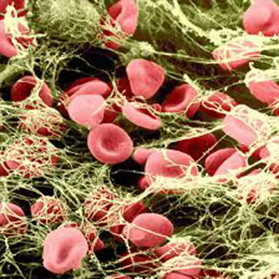 fibrinogen degradation products (fdp) test
